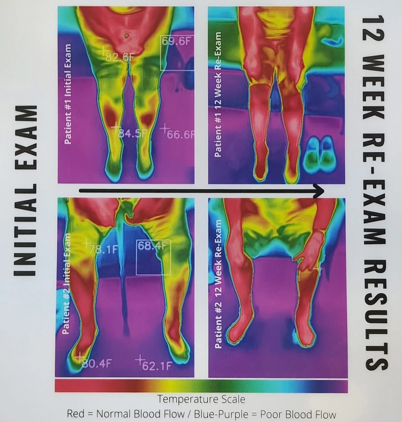Begin your road to Recovery from Neuropathy with a Simple Plan