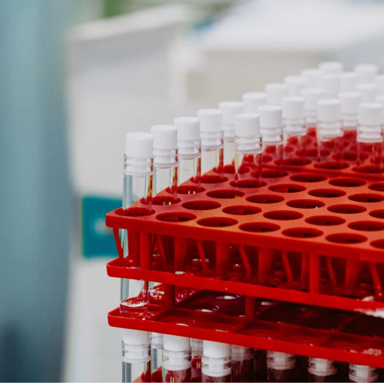 World's #1 Validated Alzheimer's Disease Test | DISCERN™