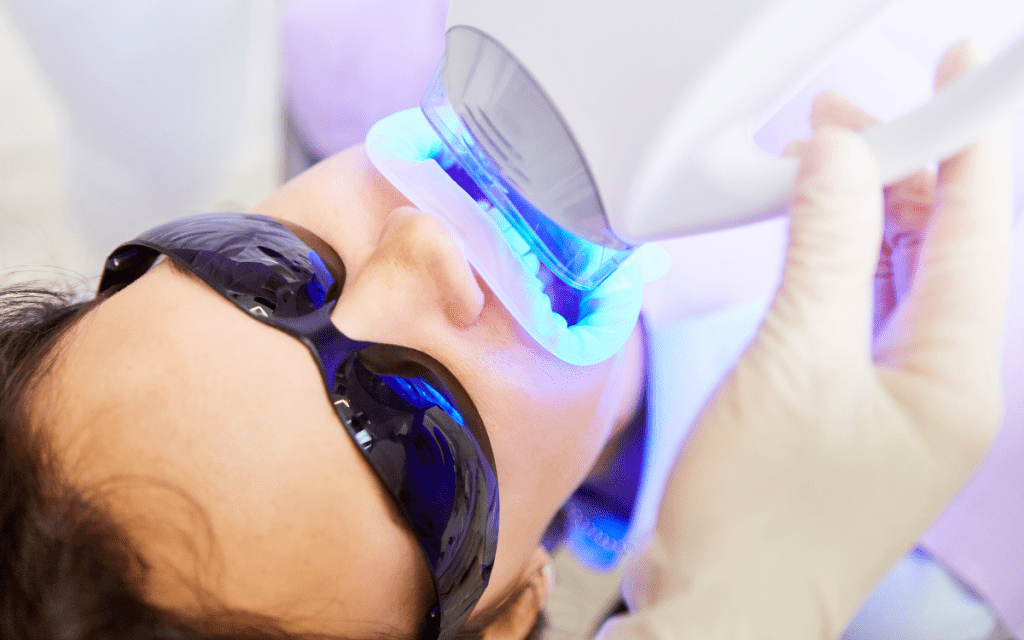 How Does LED Teeth Whitening Work? Quest Dental