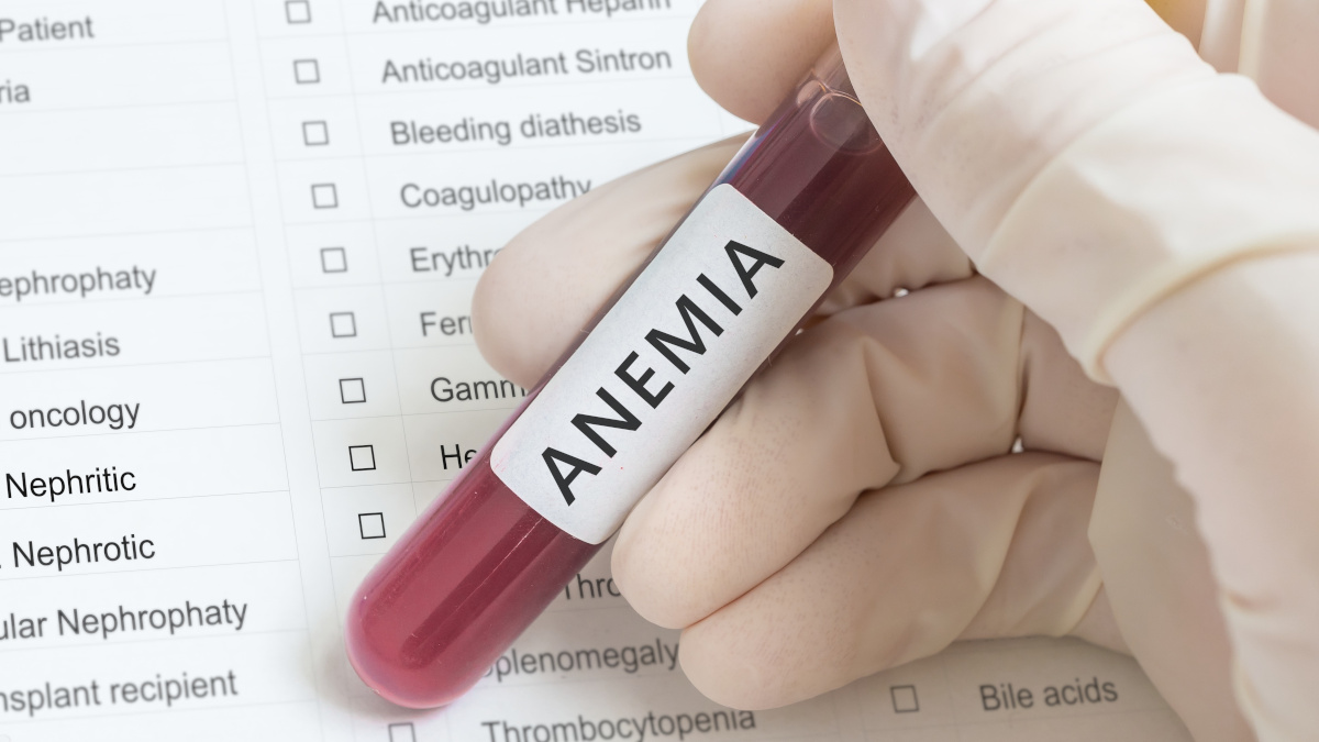 Hemolytic Anemia: Causes, Symptoms, Diagnosis, and Treatment