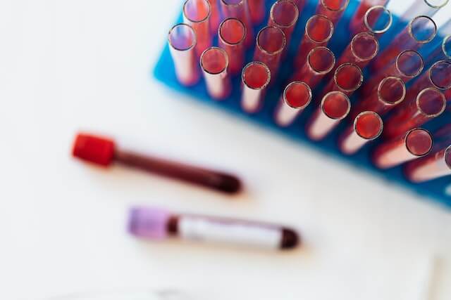 carbon-dioxide-blood-test-example