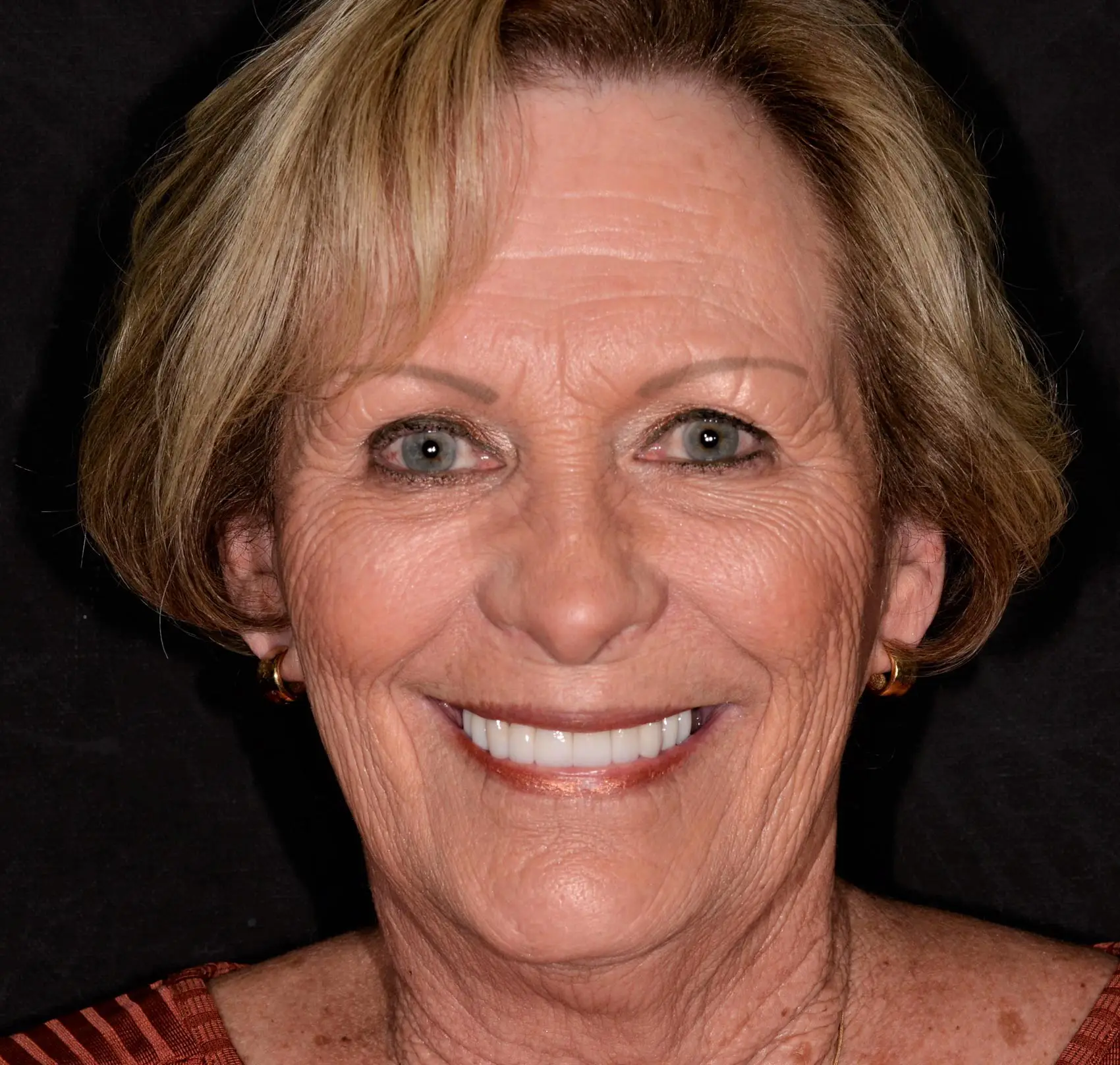 Dentist Upland CA Young Dental Health Center