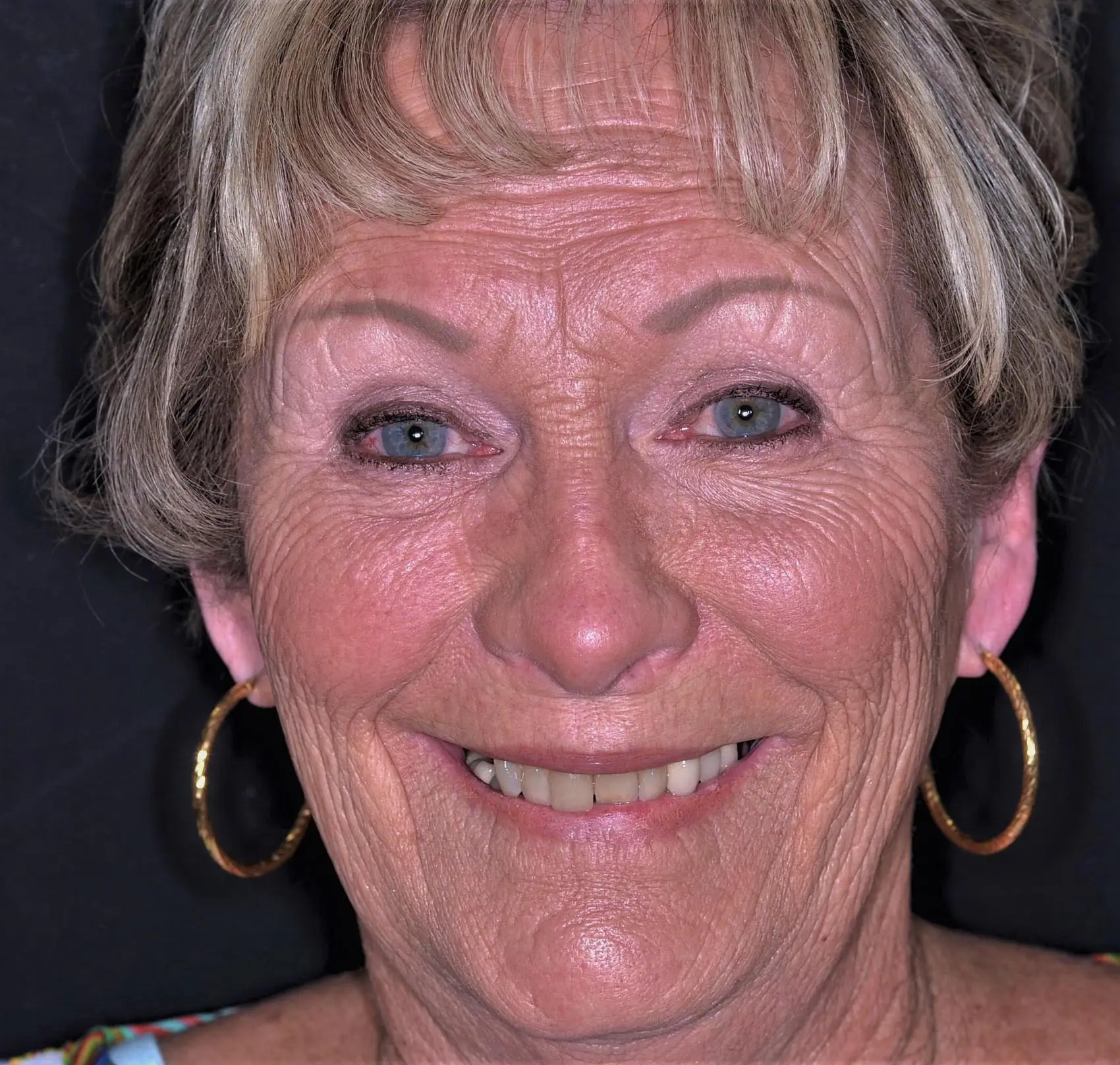 Dentist Upland CA Young Dental Health Center