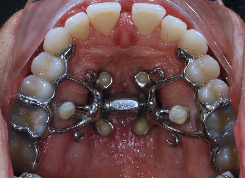 Airway orthodontist near me