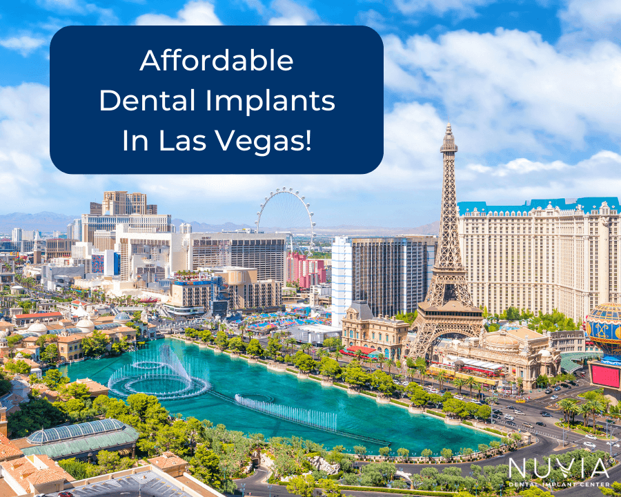 Affordable Dental Implants in Las Vegas