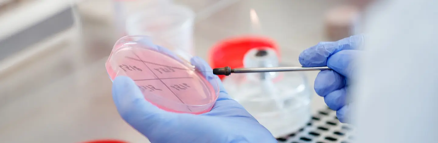 Expert Bioinformatics Consulting for Public Health Genomics | Theiagen ...