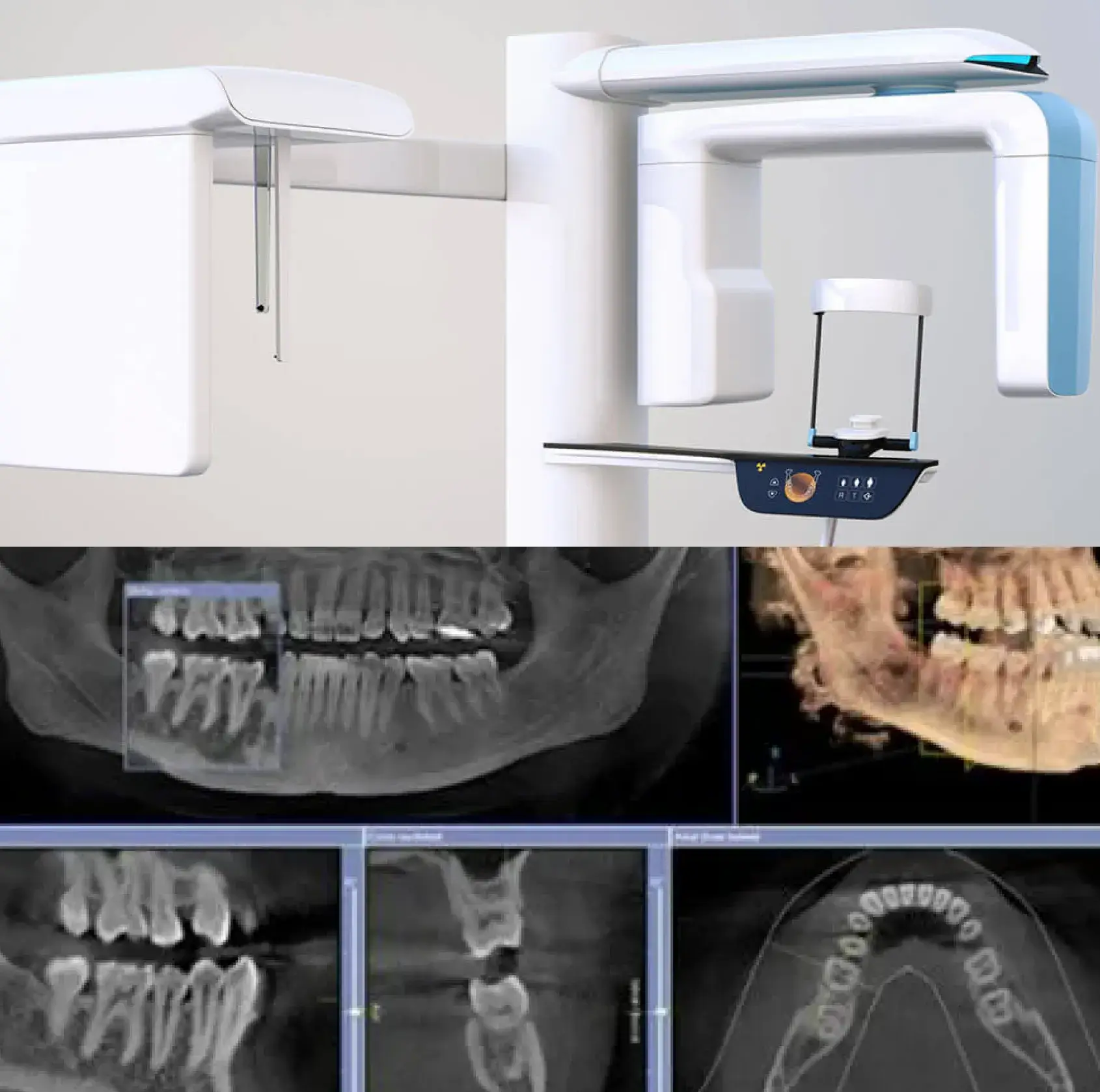 Innovative Dental Technology | Grace Dental Smiles West Babylon, NY