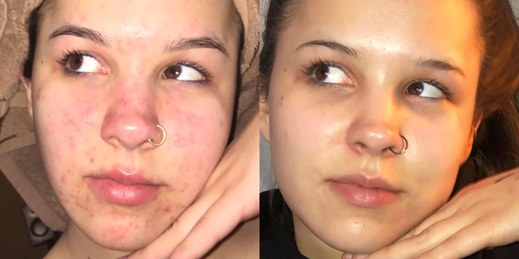 Laser Treatments Winnipeg