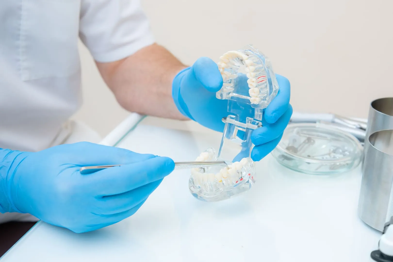 Dental Inlays and Onlays in Fort Collins, CO 80524